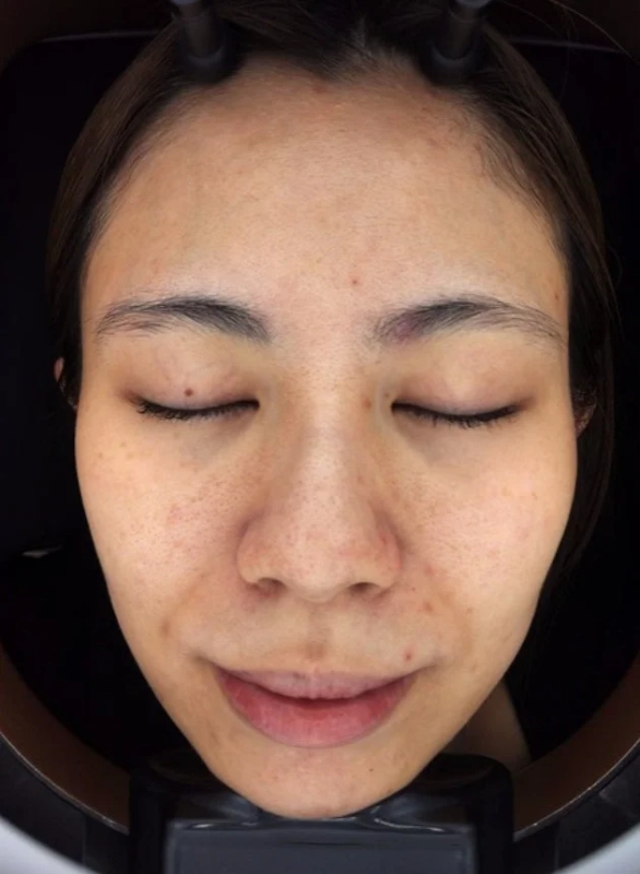 スタッフHの10日後変化