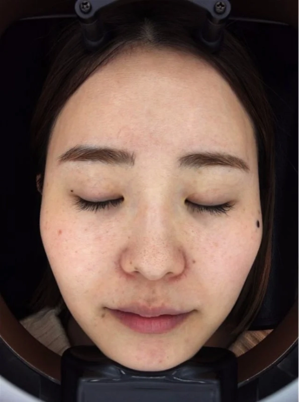 スタッフKの10日後変化 - 左